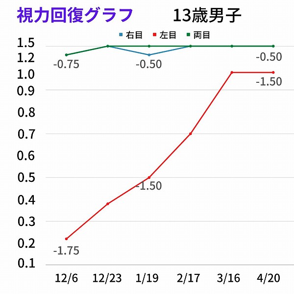 視力回復グラフ 13歳男子